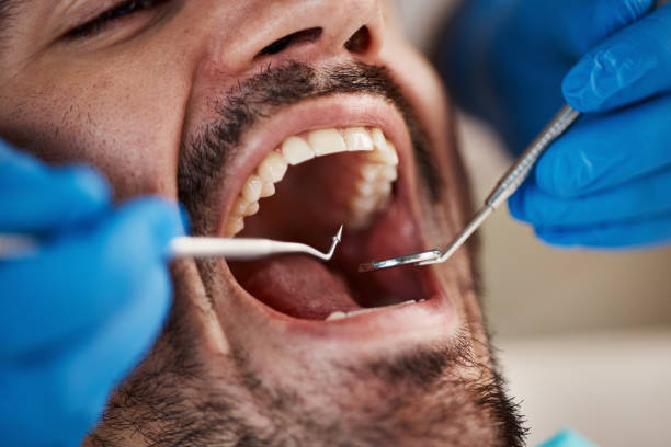 Best Dental Fillings (Composite and Amalgam)  in Adamstown, MD