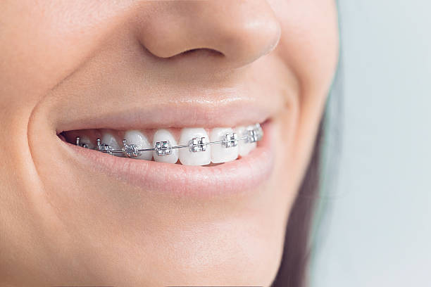 Full Mouth Reconstruction in Adamstown, MD